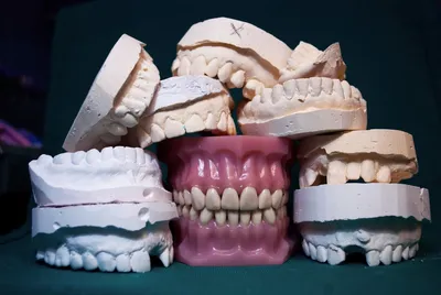 Types of Dentures You Can Get and How to Know If You Are SuitableIllustration