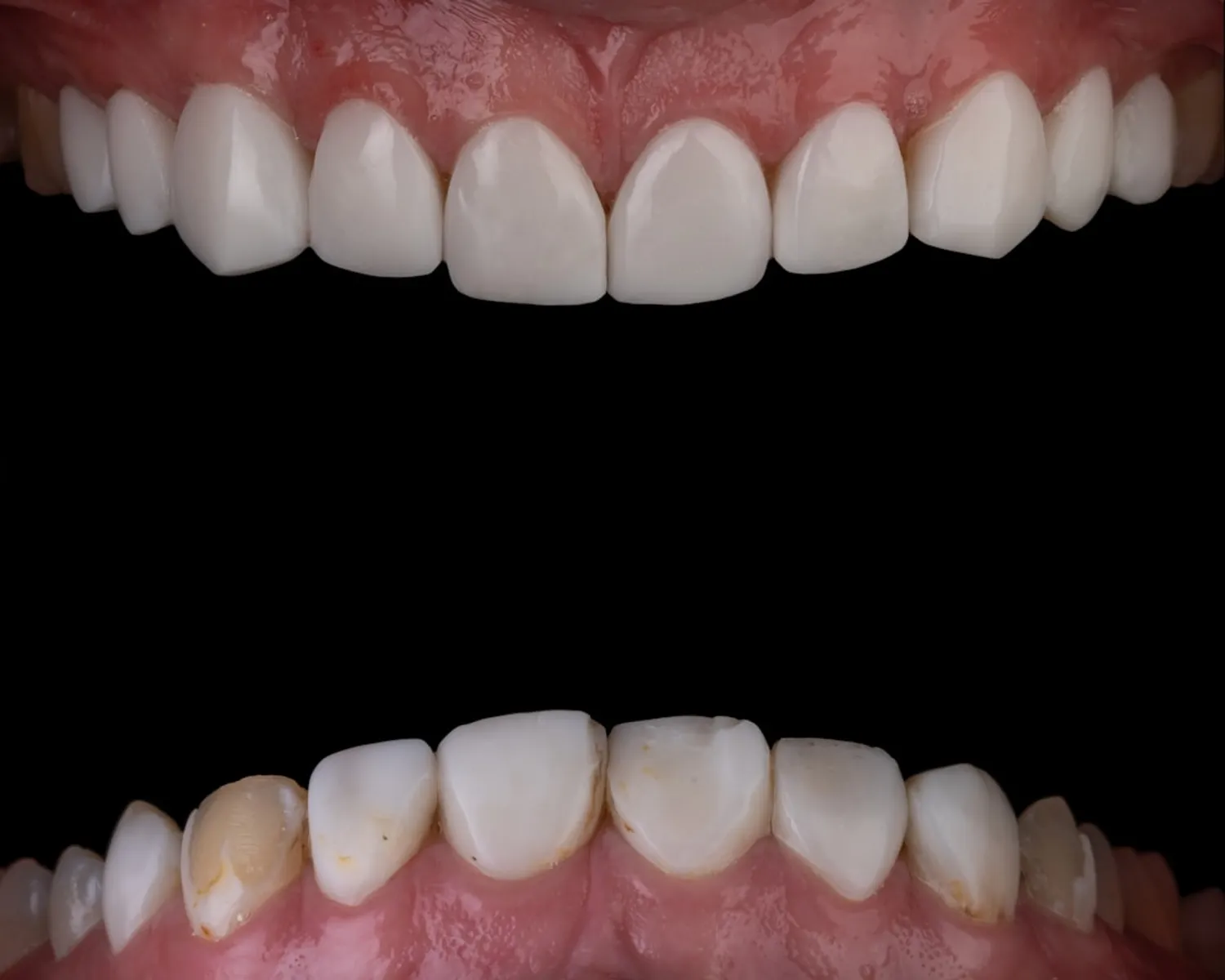 Are You a Candidate for Dental Implants? Photo