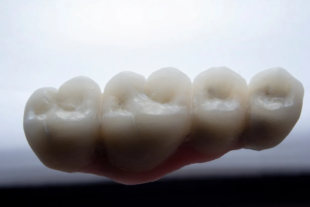 Ensuring a Comfortable Denture Fit: Key Adjustments and TechniquesIllustration