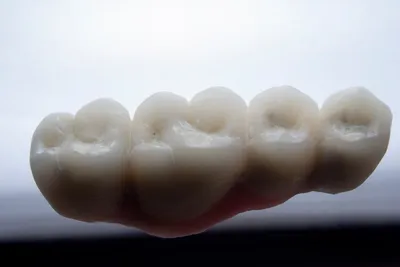 Ensuring a Comfortable Denture Fit: Key Adjustments and TechniquesIllustration