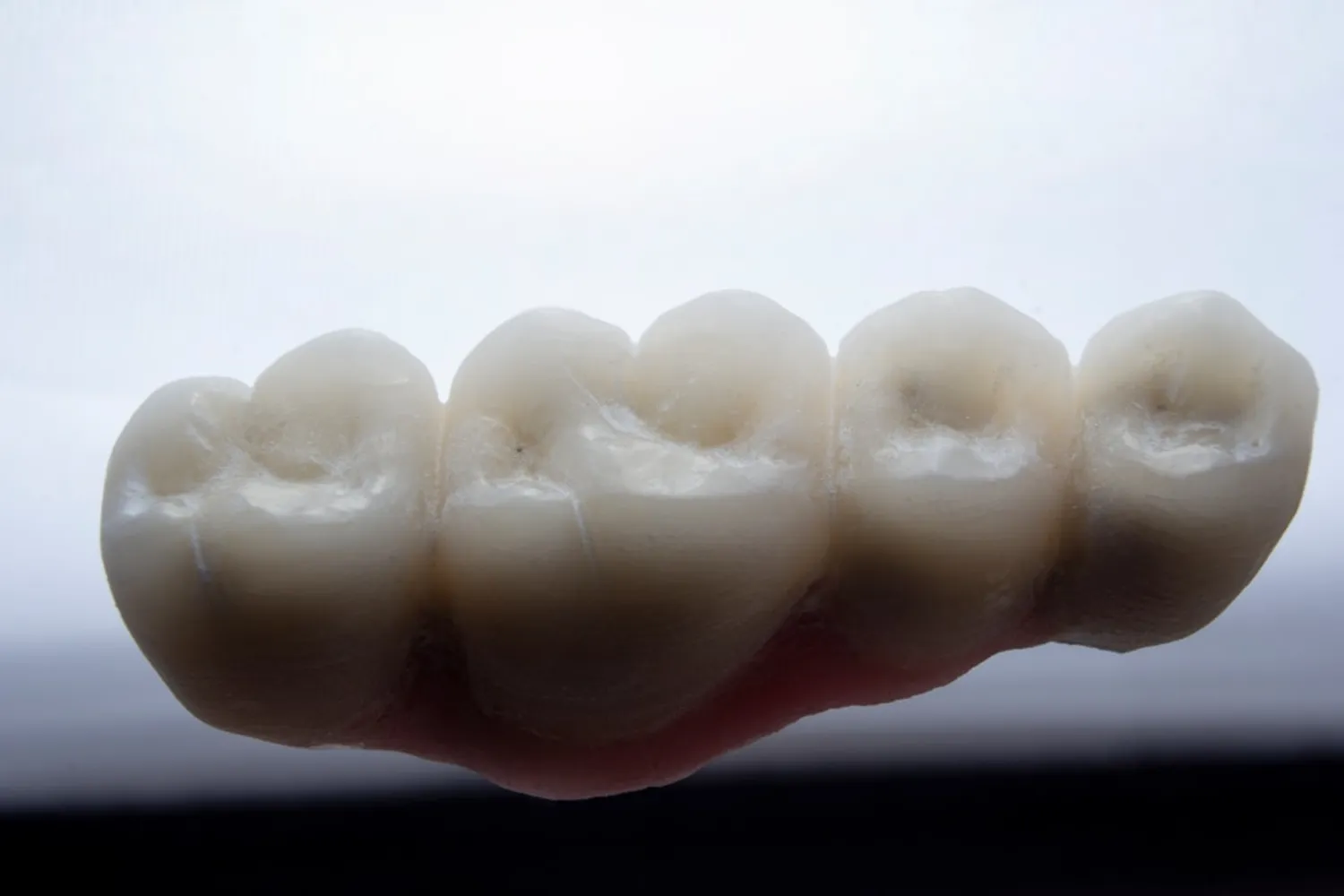 Ensuring a Comfortable Denture Fit: Key Adjustments and Techniques Photo